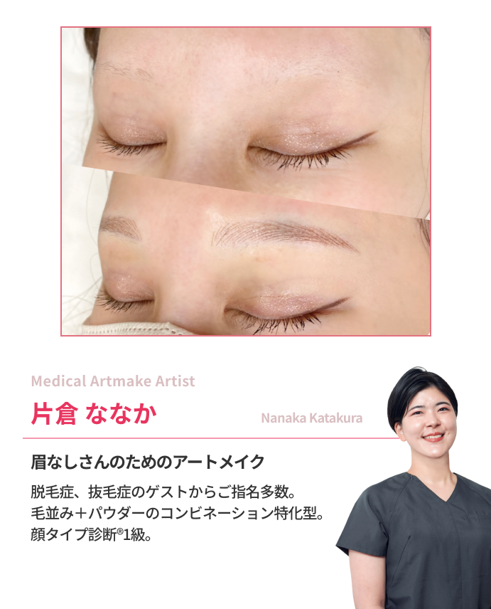 Medical Artmake Artist片倉ななか眉なしさんのためのアートメイク 脱毛症、抜毛症のゲストからご指名多数。 毛並み＋パウダーのコンビネーション特化型。 顔タイプ診断®︎1級。