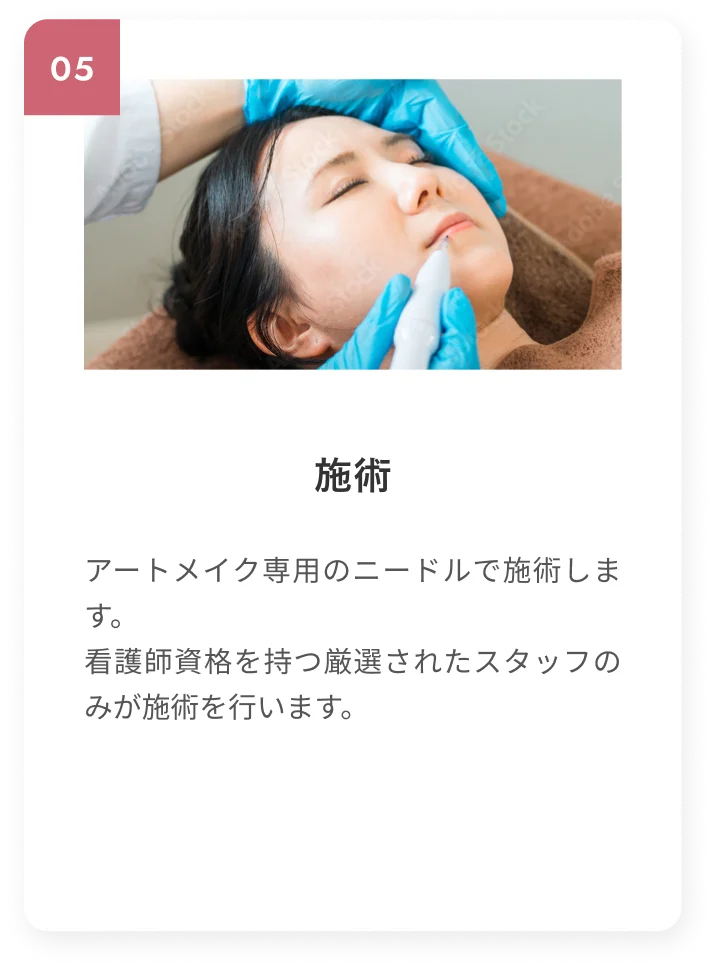 施術
