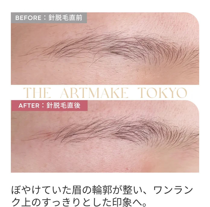 ぼやけていた眉の輪郭が整い、ワンランク上のすっきりとした印象へ。