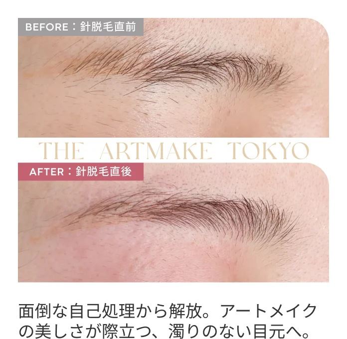 面倒な自己処理から解放。アートメイクの美しさが際立つ、濁りのない目元へ。
