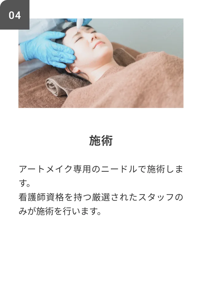 STEP04 塗る麻酔 施術部位に塗る麻酔を効かせていきます。